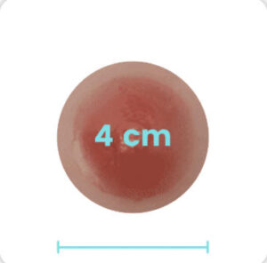 4 cm