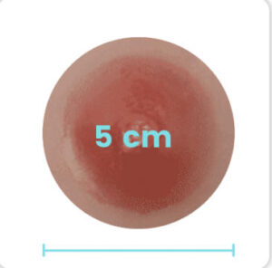 5 cm