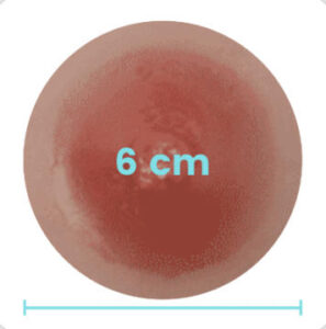 6 cm